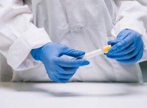 Profesional de salud con guantes extrayendo muestra de tubo de ensayo en laboratorio clínico para diagnóstico de SIBO e intolerancia a la lactosa en Cartagena